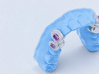 Dub Cap Grillz + Diamond + Oval